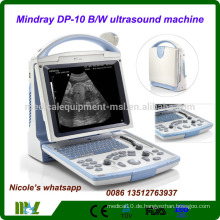 DP-10 Neueste Mindray CE FDA Laptop Ultraschall Maschine / tragbare Ultraschall Maschine mit konvexen Sonde und transvaginalen Sonde